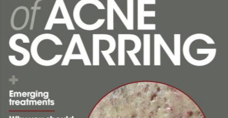 Special Dermatology Times supplement:  Acne scarring